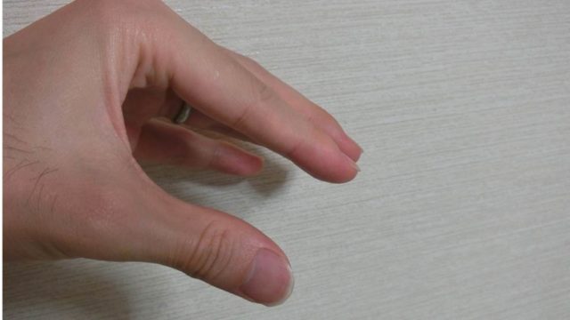 髪を触る癖があると薄毛になるのか 白丸くん