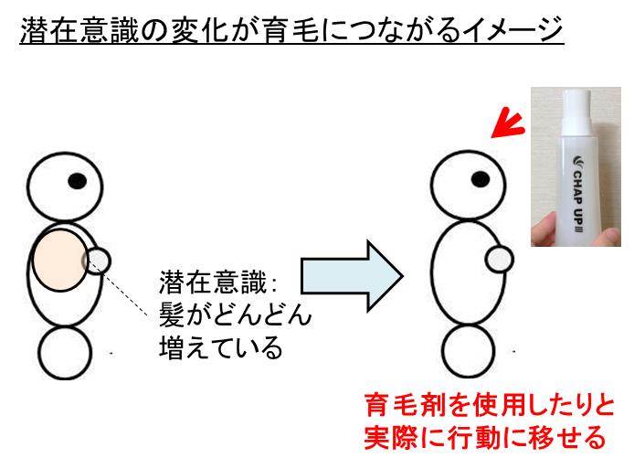 潜在意識の力で育毛できるのか 髪の毛をフサフサにできるのは本当 白丸くん