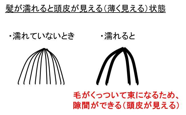 髪が濡れると頭皮が見えるのはハゲなのか 風呂上がりやシャワー モッカイ